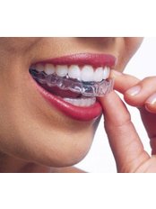 Orthodontic Retainer - Agaram Dental Clinic