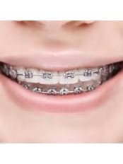 Metal Braces - Dr Richa's Cosmodent Cosmetics & Dental Clinic