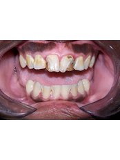 Cosmetic Dentist Consultation - Impressions dental and maxillofacial center
