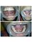 Impressions dental and maxillofacial center - Implant supported over denture 
