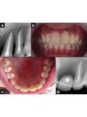 Emergency Dentist Consultation - Impressions dental and maxillofacial center