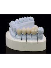 Dentist Consultation - Landmark dental care