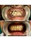 Perfect Teeth Dental Clinic & Facial Aesthetic Centre - House No. 846 Sector 70, Mohali, Punjab, 160071,  11