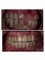 Cosmecare Dentistry - Smile designing [Case in progress] 
