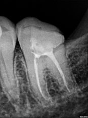 Digital Dental X-Ray - Dental Square Mumbai