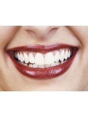 Adult Braces - Dr Sejpals Smile XL Clinic