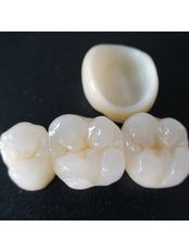 CAD/CAM Dental Restorations - dr.richa's dental serinity miraroad mumbai