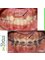 Embrace Orthodontics - 601 - Ram Krishna Chambers, Linking Road, Khar (west), Mumbai, Maharashtra, 400052,  10