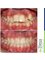 Embrace Orthodontics - 601 - Ram Krishna Chambers, Linking Road, Khar (west), Mumbai, Maharashtra, 400052,  15