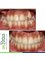 Embrace Orthodontics - 601 - Ram Krishna Chambers, Linking Road, Khar (west), Mumbai, Maharashtra, 400052,  9