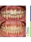 Embrace Orthodontics - 601 - Ram Krishna Chambers, Linking Road, Khar (west), Mumbai, Maharashtra, 400052,  18