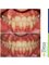 Embrace Orthodontics - 601 - Ram Krishna Chambers, Linking Road, Khar (west), Mumbai, Maharashtra, 400052,  14