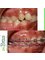 Embrace Orthodontics - 601 - Ram Krishna Chambers, Linking Road, Khar (west), Mumbai, Maharashtra, 400052,  5