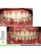 Embrace Orthodontics - Before & After 