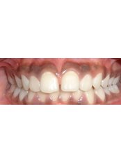 Orthodontics - Kare Dental Clinic