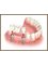 MAX Dental Clinic - implant supported bridge 