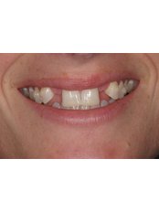 Cosmetic Dentist Consultation - My Smile MultiSpeciality Dental Clinic