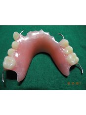 Fixed Partial Dentures - Oradent Dental Clinic