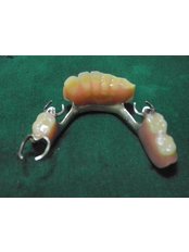 Fixed Partial Dentures - Oradent Dental Clinic
