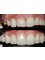 Sunfill Dental Clinic - Full Mouth Rehabilitation 