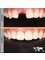 The Dental Bond - Our young 29 year old female patient lost her tooth due to an injury which resulted in fracture followed by infection. A dental implant was placed to replace the missing tooth with additional bone grafting procedures to revive that beautiful smile. 