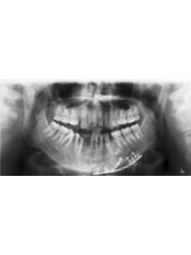 Dental X-Ray - Dental Cosmetic & Implant Centre