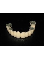 Fixed Partial Dentures - Dental Cosmetic & Implant Centre