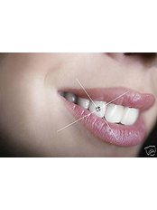 Tooth Jewellery - Dental Cosmetic & Implant Centre