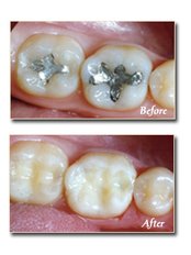 Restorative Dentist Consultation - Dental Cosmetic & Implant Centre
