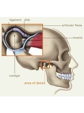TMJ - Temporomandibular Joint Treatment - Dental Cosmetic & Implant Centre