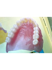 Acrylic Dentures - Dental Cosmetic & Implant Centre