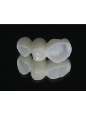 Porcelain Bridge - Dental Cosmetic & Implant Centre