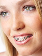 Orthodontist Consultation - Dental Cosmetic & Implant Centre