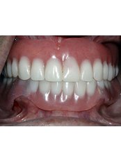 Overdentures - Dental Cosmetic & Implant Centre