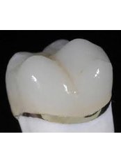 Zirconia Crown - Dental Cosmetic & Implant Centre