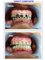 Jaiswal Dental Clinic - Cosmetic fillings 