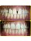 Jaiswal Dental Clinic - Smile designing 