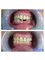 Jaiswal Dental Clinic - Full mouth rehab. 