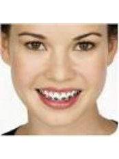 Braces - ARC Dental Clinic