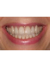 Fixed Partial Dentures - Dental Speciality Clinic