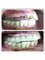 Dr Kochhars  Children| Dental & Orthodontic Centre - dental implants with life time warranty 