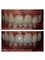 Healthy Smiles Dental Care Centre - 53/35 Ramjas Road, Karol Bagh, New Delhi, Delhi, 110005,  79