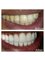 Healthy Smiles Dental Care Centre - 53/35 Ramjas Road, Karol Bagh, New Delhi, Delhi, 110005,  18