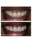 Healthy Smiles Dental Care Centre - 53/35 Ramjas Road, Karol Bagh, New Delhi, Delhi, 110005,  82