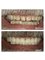 Healthy Smiles Dental Care Centre - 53/35 Ramjas Road, Karol Bagh, New Delhi, Delhi, 110005,  71