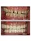 Healthy Smiles Dental Care Centre - 53/35 Ramjas Road, Karol Bagh, New Delhi, Delhi, 110005,  67