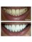 Healthy Smiles Dental Care Centre - Cosmetic Smile Makeover Dentist in INDIA 