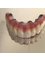 Dentique Dental & Implant Centre - Amrapali crystal shopping arcade Sector 76, Noida, Uttar pradesh, 201301,  12