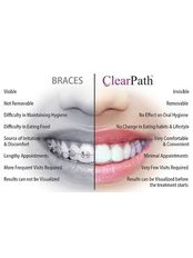 Clear Braces - Dentafix Multispecialty Dental Clinic