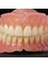 Magadh Oro Dental - Implant & Orthodontic Clinic - complete Denture 